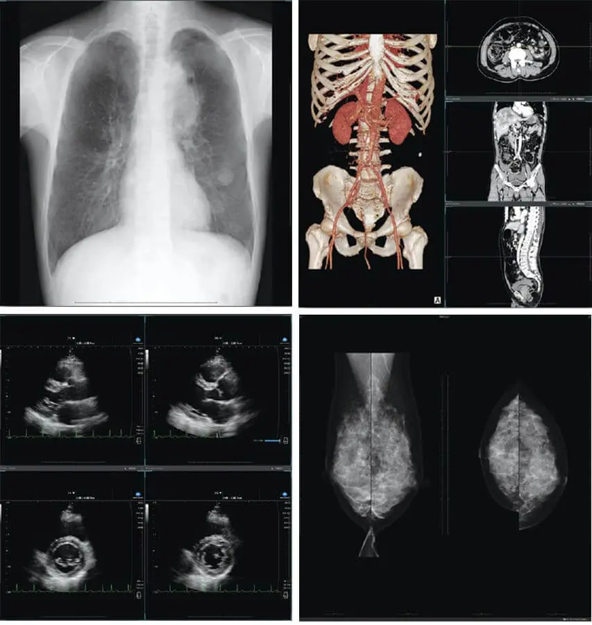 Various operations