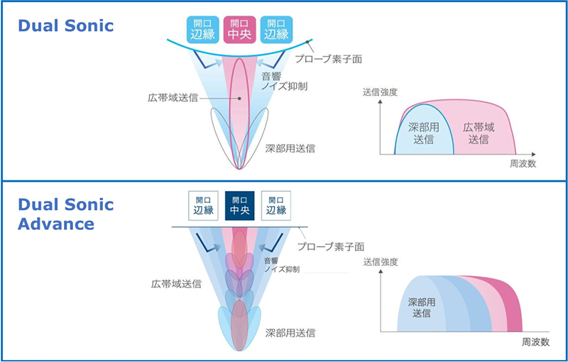 「Dual Sonic Advance」と「Dual Sonic」の比較図