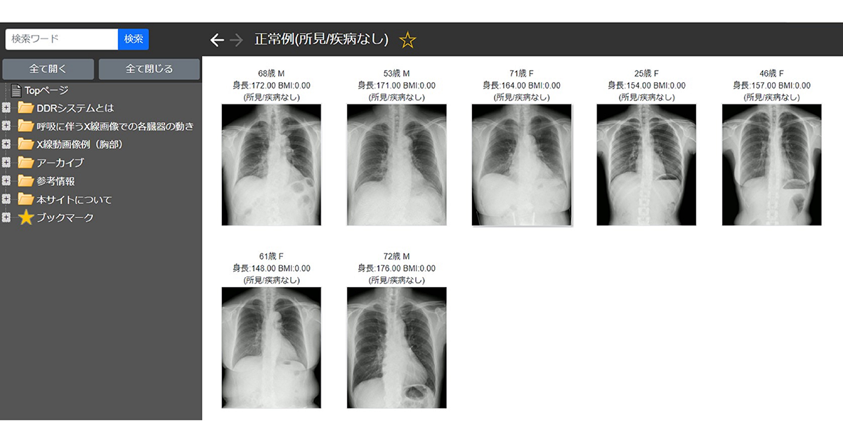 SHIMADZU CORPORATION : Dynamic Digital Radiology Added to Mobile X