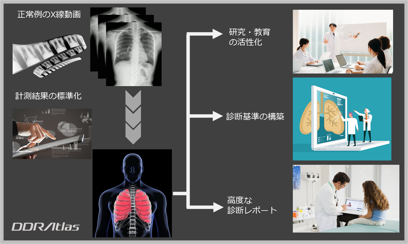 SHIMADZU CORPORATION : Dynamic Digital Radiology Added to Mobile X