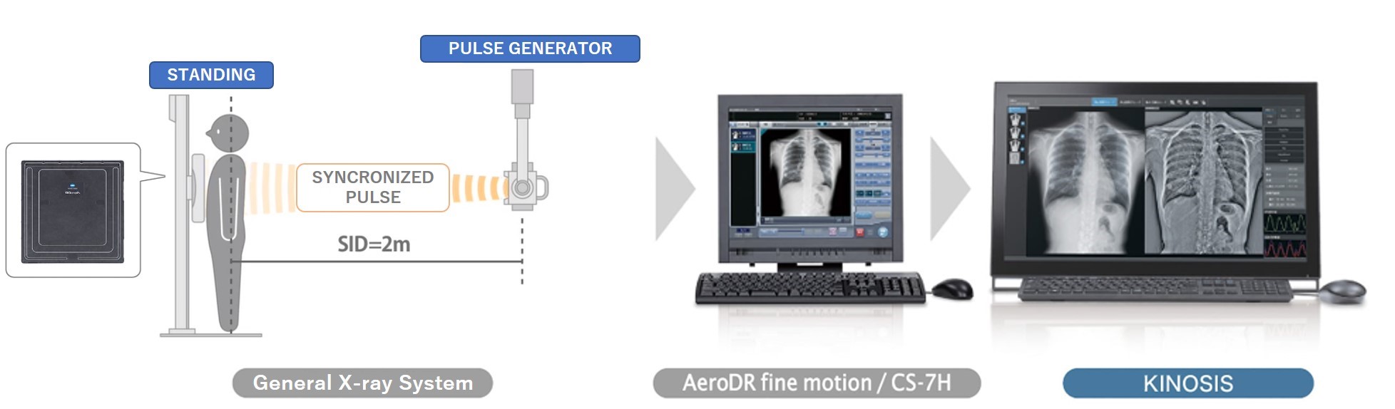 Konica Minolta Releases DDRAtlas Ver. 1.0, Dynamic Digital Radiography  Atlas in Japan Taking on a Challenge in New Dynamic Imaging Diagnosis for  General Radiography